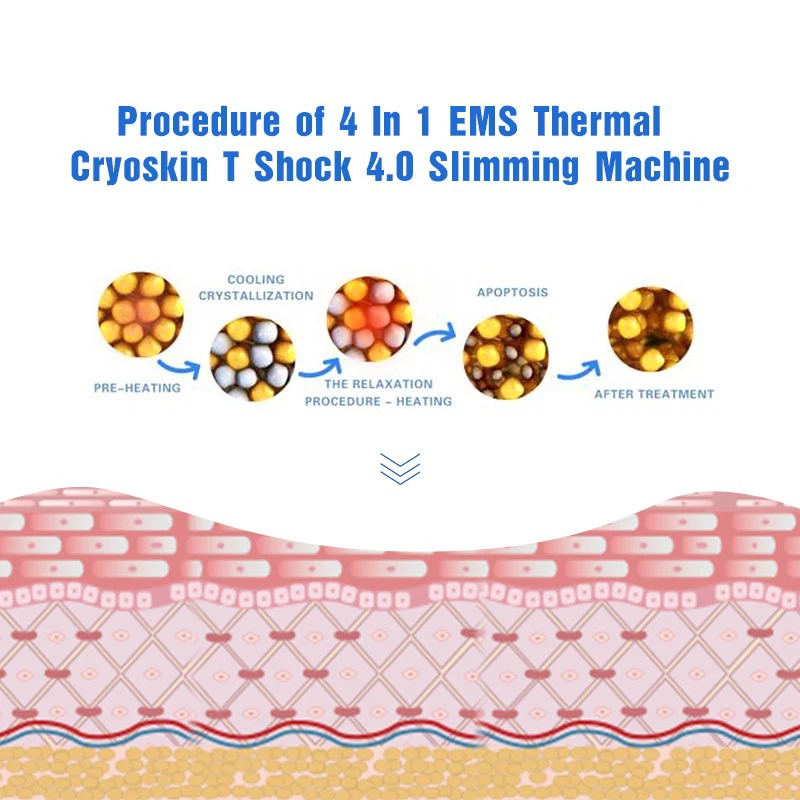 Cryoskin Machine – Professional Non-Invasive Slimming & Skin Rejuvenation Solution factory