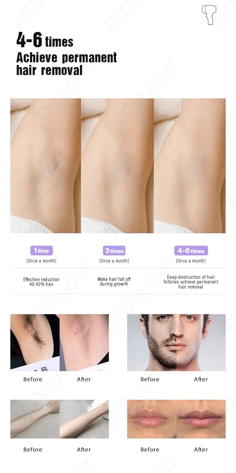 Titanium Diode Laser Hair Removal Machines price